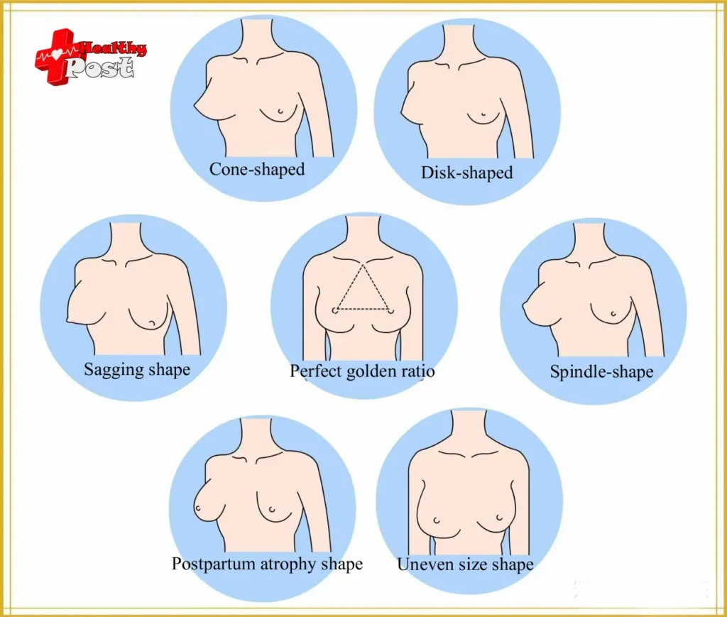 Different breast shapes