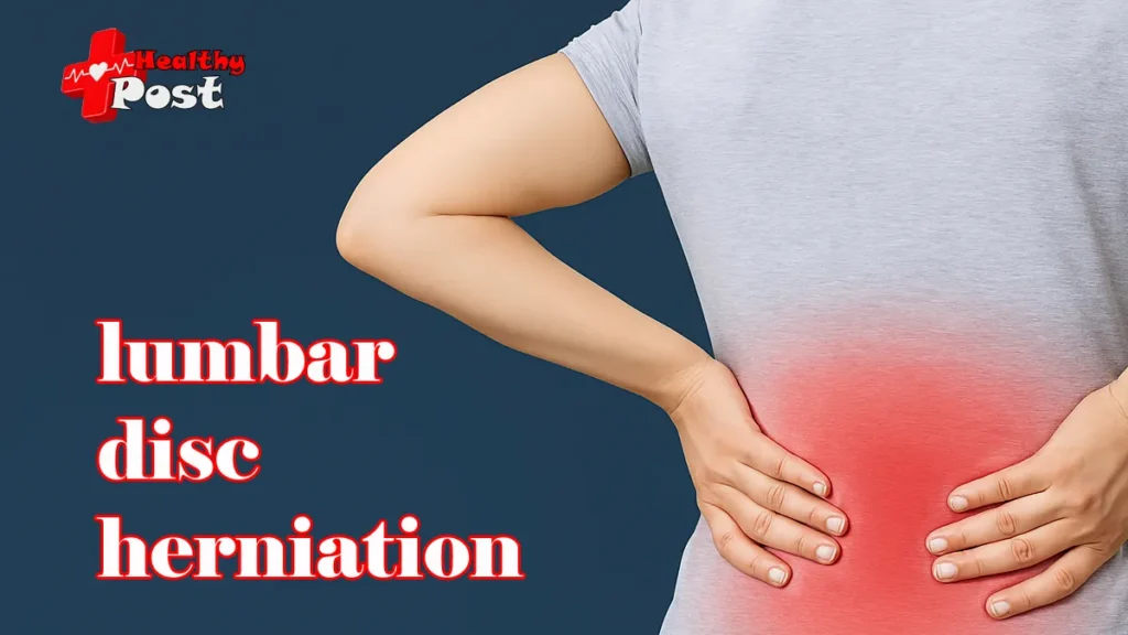 lumbar disc herniation