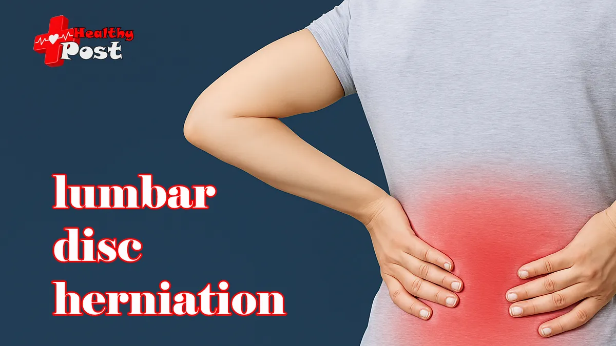 lumbar disc herniation