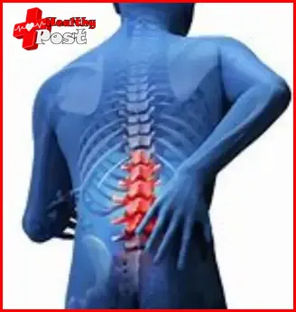 lumbar disc herniation