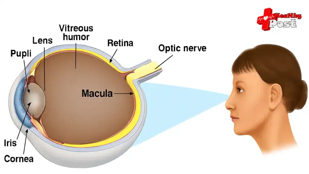 cataract surgery