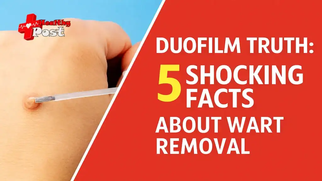 Duofilm Truth: 5 Shocking Facts About Wart Removal duofilm wart