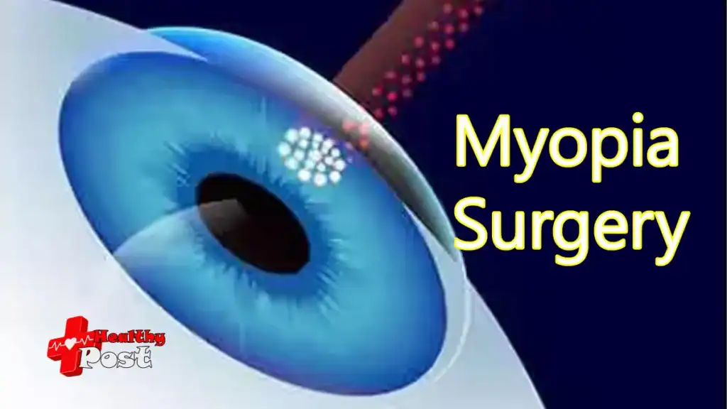 Which of the 4 types of myopia surgery is the most reliable? myopia surgery