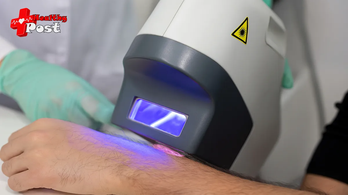 excimer laser therapy