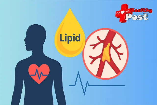 hypertriglyceridemia icd 10