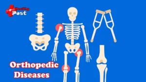 orthopedic diseases