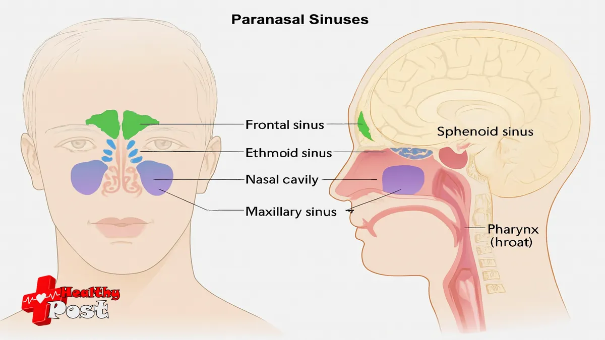 sinus headache