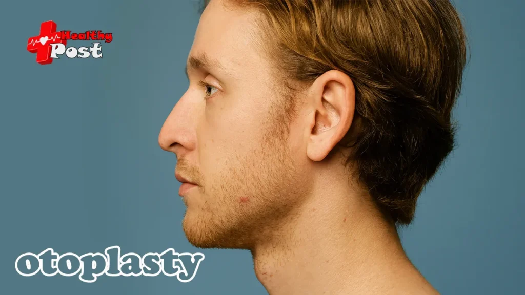 5 Shocking Truths About Otoplasty in Turkey Cost and Before After Transformations otoplasty in turkey