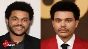the weeknd plastic surgery