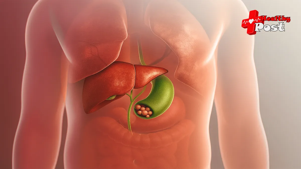 which size of gallbladder stone is dangerous